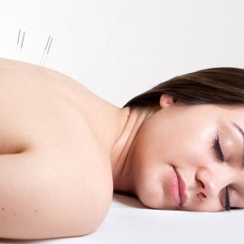 Acupuntura
