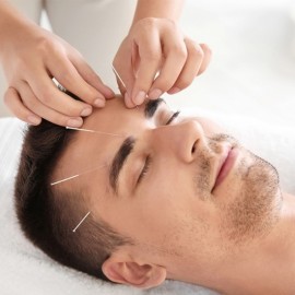 Acupuntura Estética